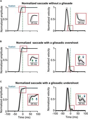 Glissades Are Altered by Lesions to the Oculomotor Vermis but Not by Saccadic Adaptation